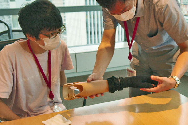 義手を確認する理学療法士